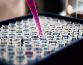 面对海量国际竞赛，如何精准PICK适合你的内容？